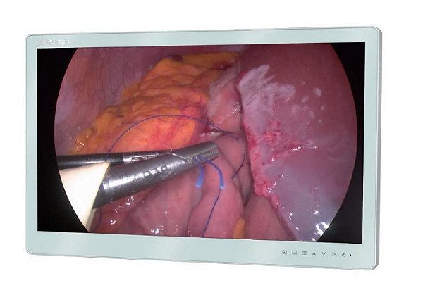 Monitor Cirúrgico 27” MS270P 1920 x 1080 - Reshin