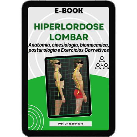 E-book: HIPERLORDOSE LOMBAR: Anatomia, cinesiologia, biomecânica, posturologia e exercícios corretivos.