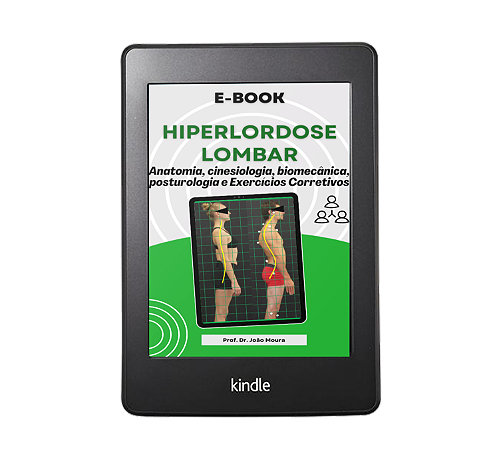 E-book - HIPERLORDOSE LOMBAR: Anatomia, cinesiologia, biomecânica, posturologia e exercícios corretivos.