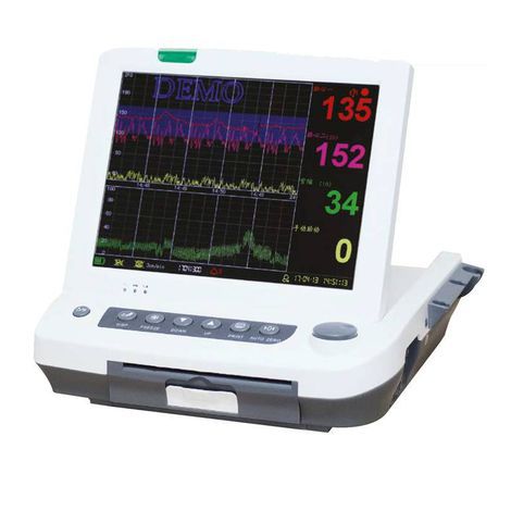 Monitor Fetal Cardiotocografo Tela 12,1" com Impressora Gemelar e Monitorização Materna MF9200 Plus Medpej