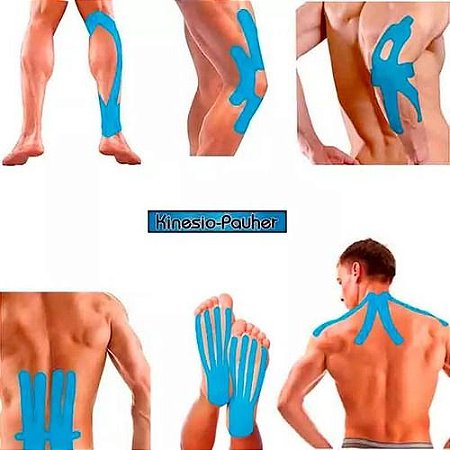 KP133 -  Kinesio Pauher Pre Cut Aplicação