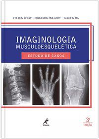 IMAGINOLOGIA MUSCULOESQUELÉTICA - CHEW, FELIX S.