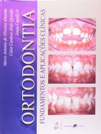 ORTODONTIA FUNDAMENTOS E APLICAÇÕES CLÍNICAS - ALMEIDA