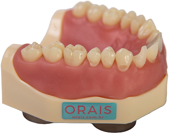 Manequim Dentística superior preparo para faceta (cod.103)