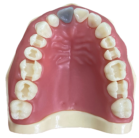 Manequim Dentística superior preparo para faceta (cod.103N) - Orais  Manequins Odontológicos