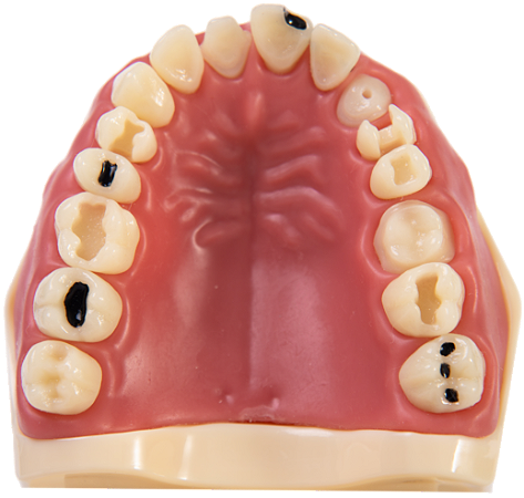 MANEQUIM DE MATERIAIS DENTÁRIOS 217 SUPERIOR (cod.217SUP)
