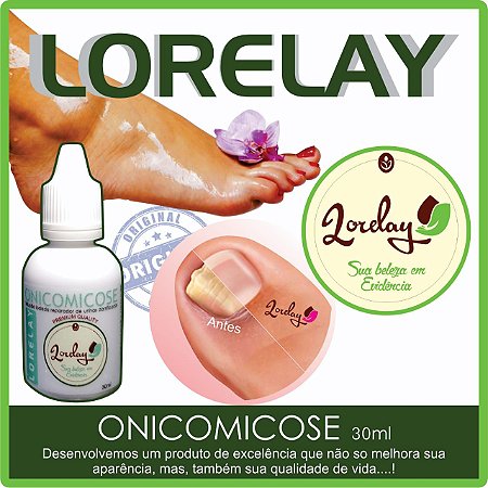 ONICOMICOSE