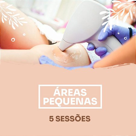 Depilação a Laser - 5 sessões de áreas pequenas