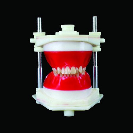TYPODONT CLASSE II - PRIMEIRA DIVISÃO APINHAMENTO SUPERIOR INFERIOR EXTRAÇÕES 14, 24, 34, 44