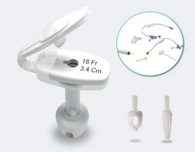 DUPLICADO - Kit para Gastrostomia Endoscópica Percutânea (KIT PEG) - BLENTA (Sonda de Início) 20FR