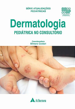 DERMATOLOGIA PEDIÁTRICA NO CONSULTÓRIO