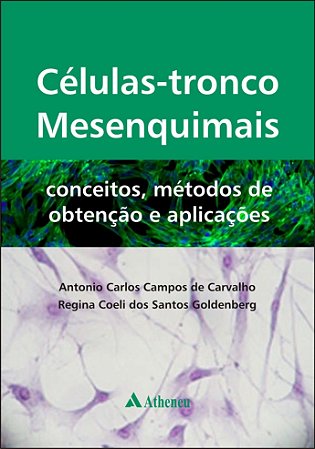 CELULAS TRONCO MESENQUIMAIS