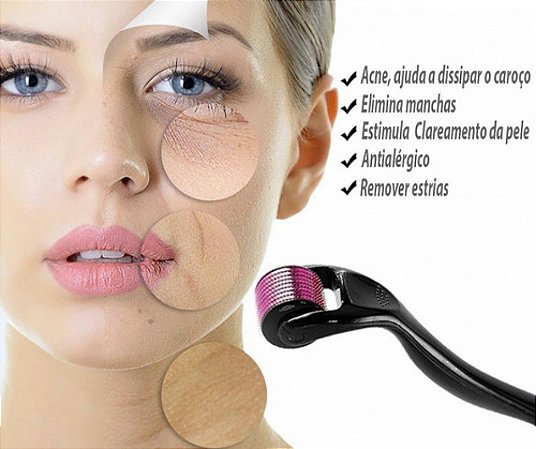 Mesoroller System 540 Microagulhamento Facial Rosto 1.0