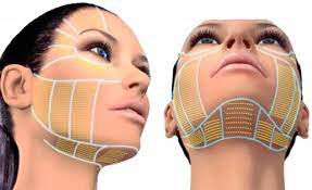 Ultraformer/Ultrassom Microfocado Face Completa