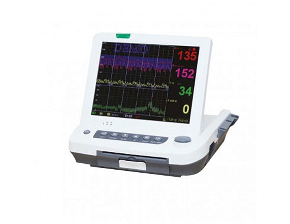 Monitor Fetal Cardiotocógrafo Tela 12 " com Impressora (Monitoramento Gemelar) MF-9200 - Medpej