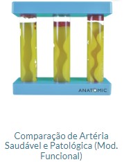 COMPARAÇÃO DE ARTÉRIA SAUDÁVEL E PATOLÓGICA