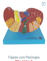 FÍGADO COM PATOLOGIA