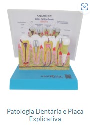 PATOLOGIA DENTÁTIA E PLACA EXPLICATIVA