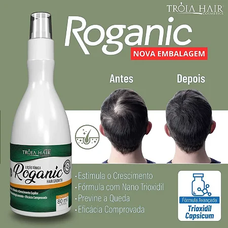 MINOXIDIL MINOX 15- 100ML