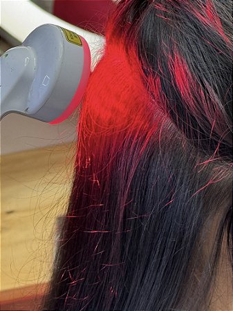 Sessão de terapia capilar