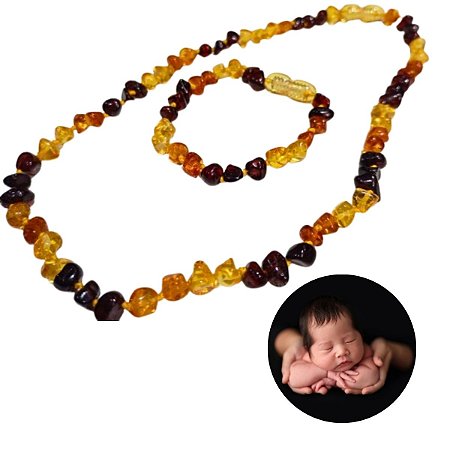 Kit Âmbar Alívio De Dentição E Cólicas De Forma Natural