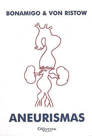 Livro Aneurismas   Bonamigo