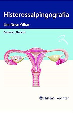 Livro Histerossalpingografia: Um Novo Olhar  Navarro