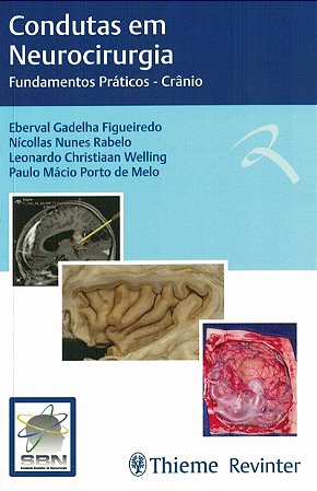 Livro Condutas em Neurocirurgia - Crânio - Figueiredo - Revinter