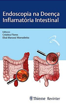 Livro Endoscopia na Doença Inflamatória Intestinal