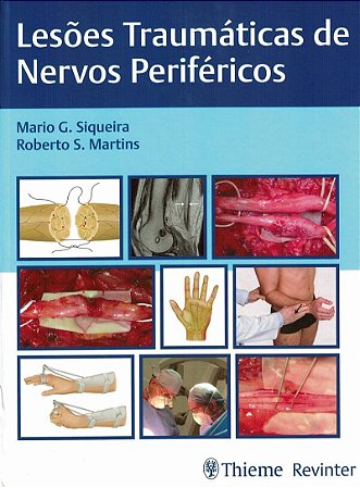 Livro Lesoes Traumaticas de Nervos Perifericos - Siqueira