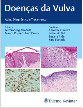 Livro Doenças da Vulva: Atlas, Diagnóstico e Tratamento Almeida