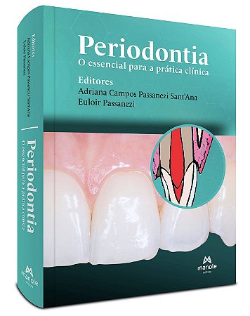 Livro Periodontia: o Essencial para a Prática Clínica - Santana - Manole