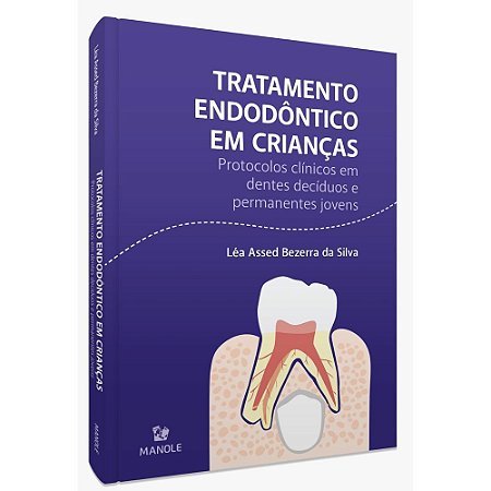 Livro Tratamento Endodôntico em Crianças