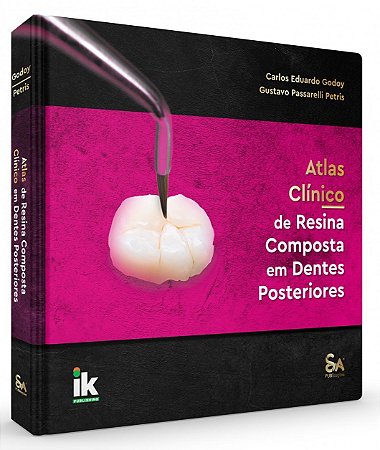 Livro Atlas Clínico de Resina Composta em Dentes Posteriores