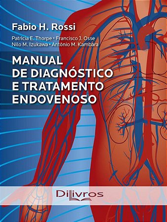 Livro Manual de Diagnóstico e Tratamento Endovenoso - Rossi