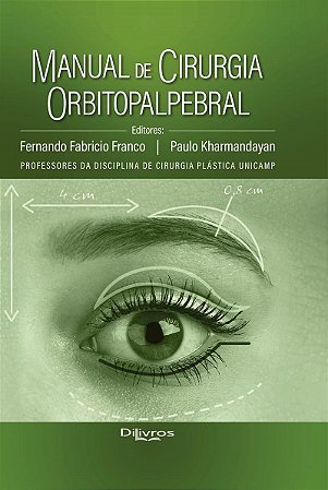 Livro Manual de Cirurgia Orbitopalpebral  Franco