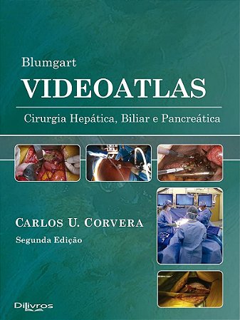 Livro Blumgart Videoatlas: Cirurgia Hepática Biliar e Pancreática