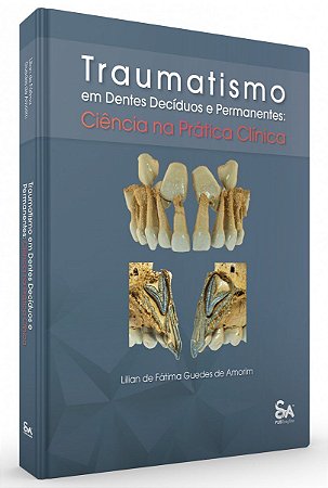 Livro Traumatismo em Dentes Decíduos e Permanentes - Amorim - Santos Pub