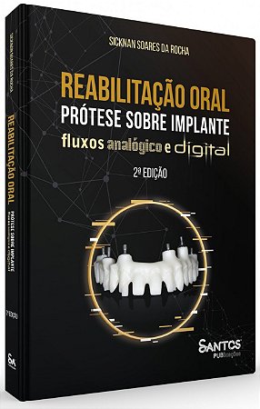 Livro Reabilitação Oral: Prótese sobre Implante Fluxos Analógico e Digital