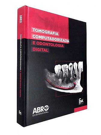 Livro Tomografia Computadorizada e Odontologia Digital - Abro - Santos Pub