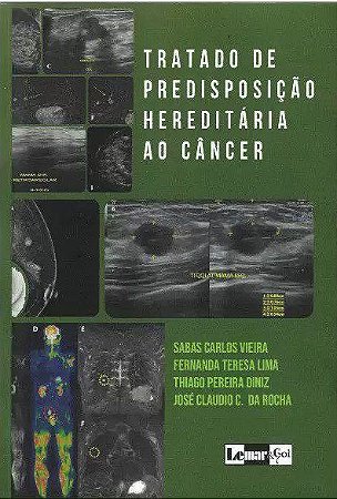 Livro Tratado de Predisposição Hereditária ao Câncer