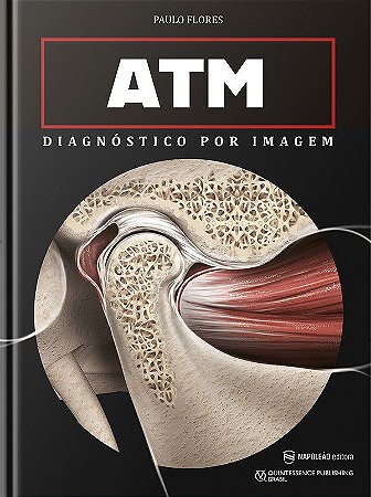 Livro ATM Diagnóstico por Imagem