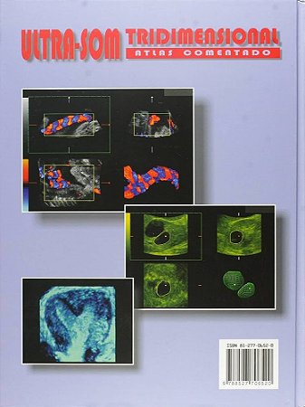 Livro Ultra-som Tridimensional - Atlas Comentado - Montenegro