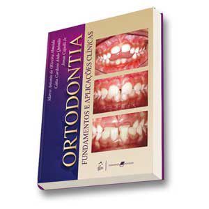 Livro Ortodontia: Fundamentos e Aplicações Clinícas: Almeida