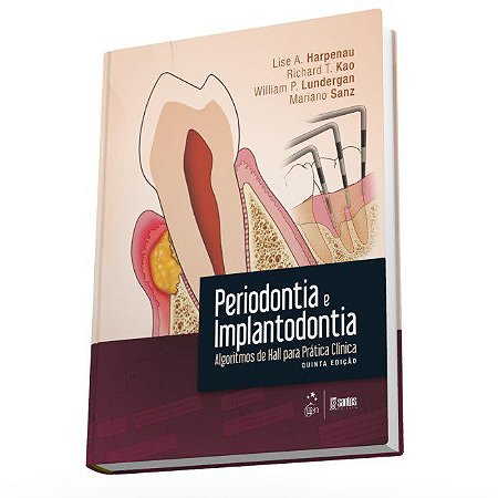 Livro Periodontia e Implantodontia - Algoritmos de Hall para Pratica Clinica - Harpenau/kao/lunderg