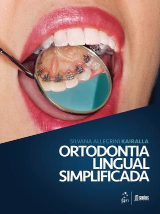 Livro Ortodontia Lingual Simplificada - Kairalla