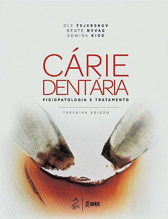 Livro Cárie Dentária: Fisiopatologia e Tratamento: Fejerskov