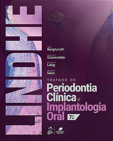 Livro Tratado de Periodontia Clínica e Implantologia Oral Lindhe