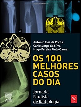 Livro Os 100 Melhores Casos do Dia - Rocha