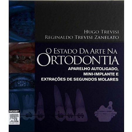 Livro Estado da Arte Na Ortodontia, O - Trevisi ***